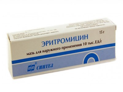 Чим мазати шви