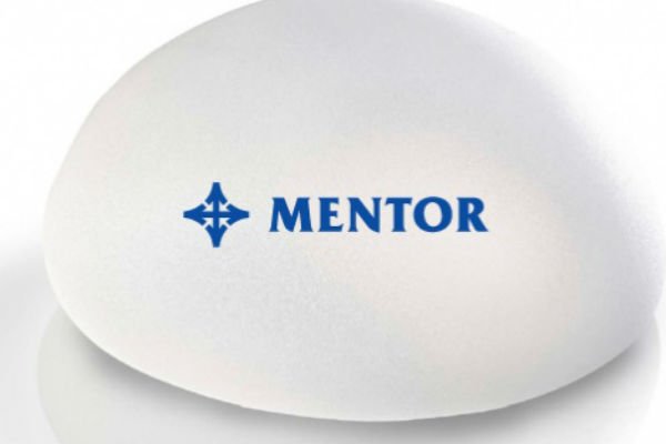імпланти ментор