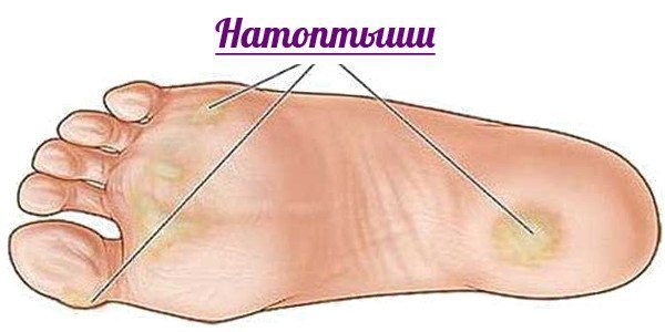 натоптиші