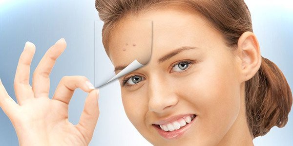 Для чого потрібна лазерна чистка обличчя