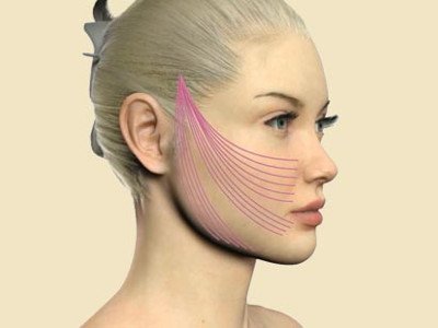 Нитки 4D для підтяжки обличчя