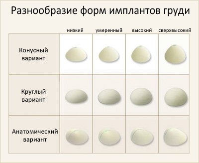 грудні імплантати