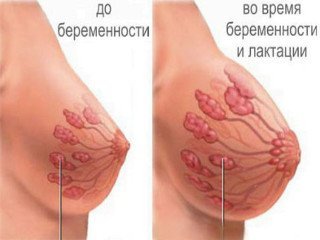 Збільшення молочних залоз при вагітності