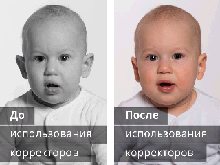 Корекція вушних раковин