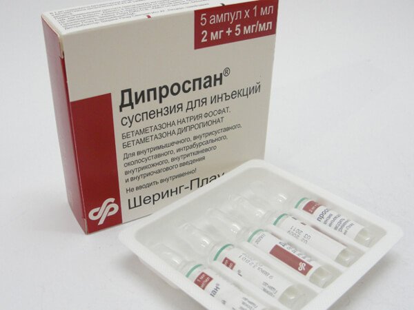 Дипроспан для зняття набряків після ринопластики